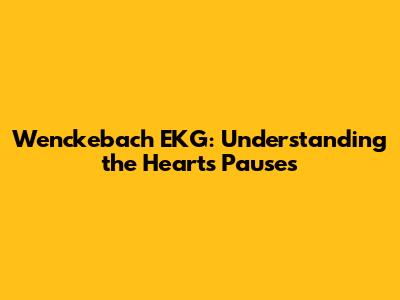Wenckebach EKG: Understanding the Heart's Pauses
